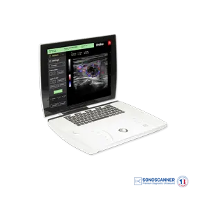 Échographe portable Ondina présenté dans le showroom IDO